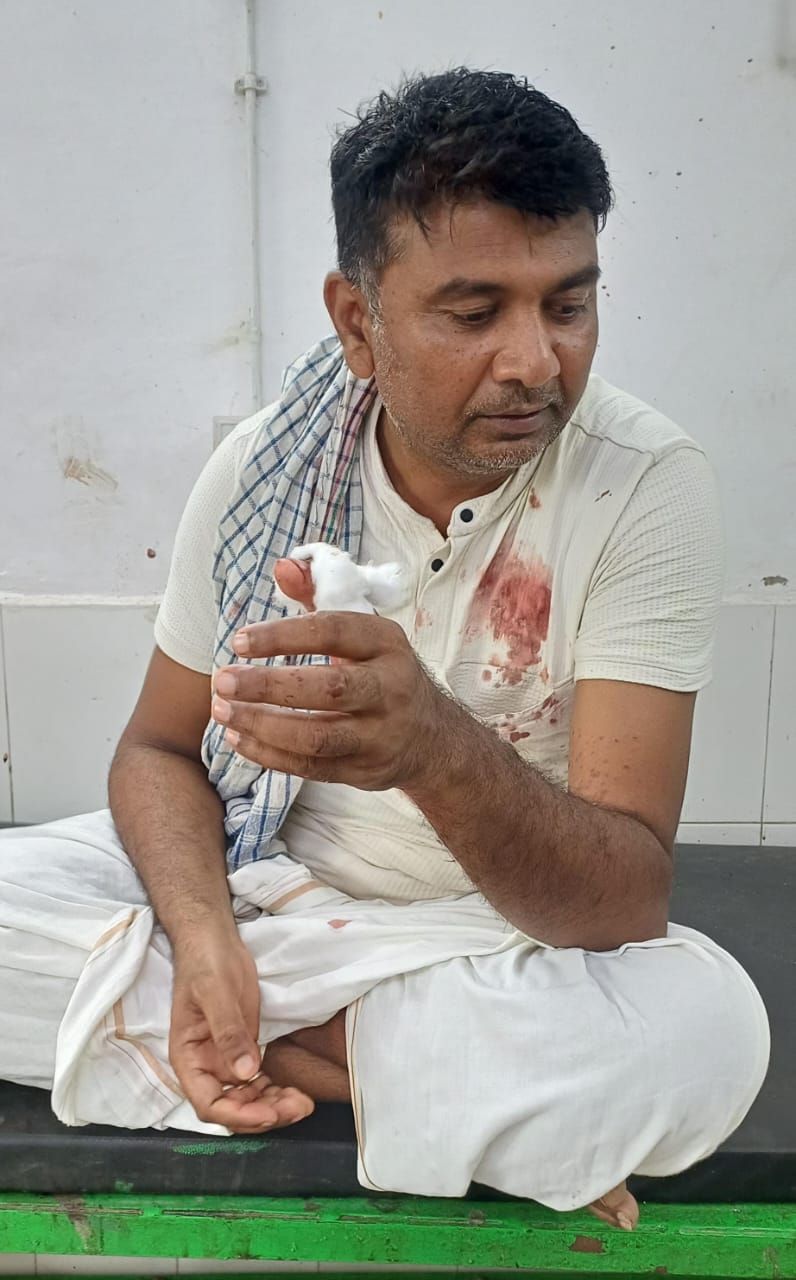 बाइक सवार अपराधियों ने पंचायत समिति सदस्य को मारी गोली,बाल-बाल बचे,अस्पताल में भर्ती