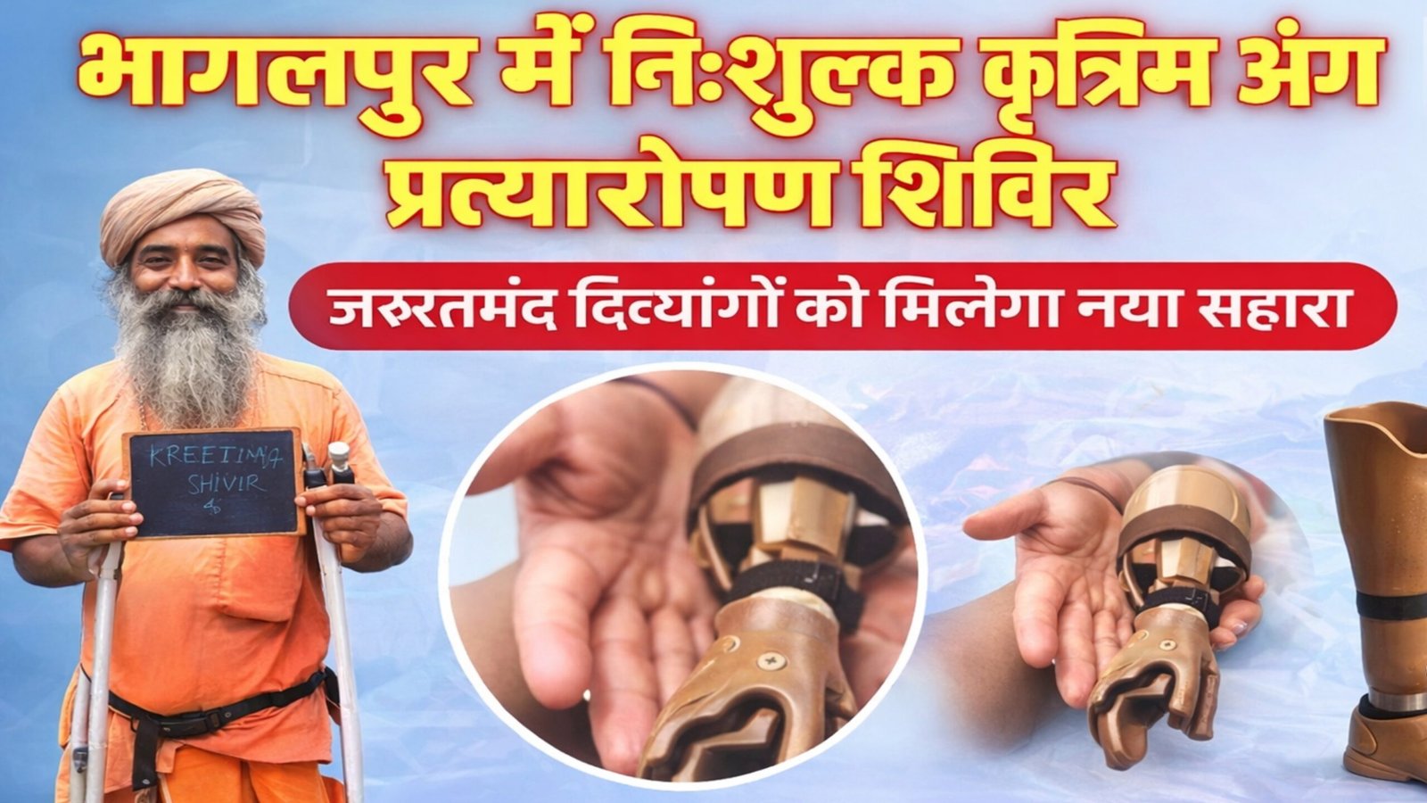 भागलपुर में नि:शुल्क कृत्रिम अंग प्रत्यारोपण शिविर का 7-9 अप्रैल को होगा आयोजन, जरूरतमंद दिव्यांगों को मिलेगा नया सहारा