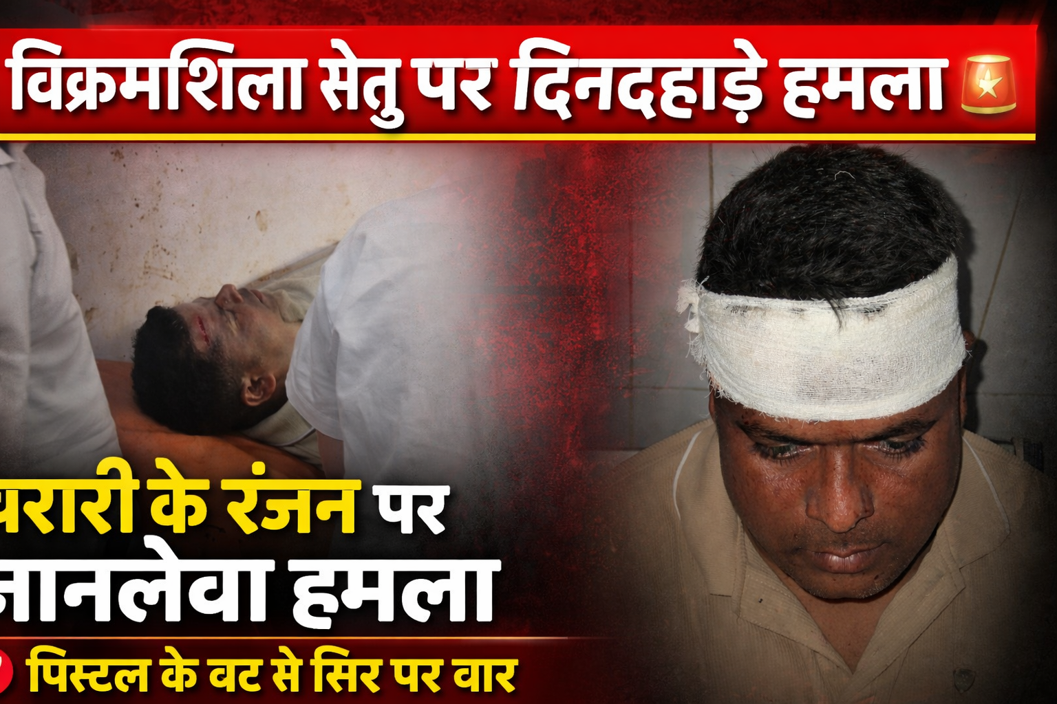 विक्रमशिला पुल पर दिनदहाड़े गुंडागर्दी: बरारी के रंजन पर जानलेवा हमला, पिस्टल के बट से फोड़ा सिर, गंगा में फेंकने की दी धमकी