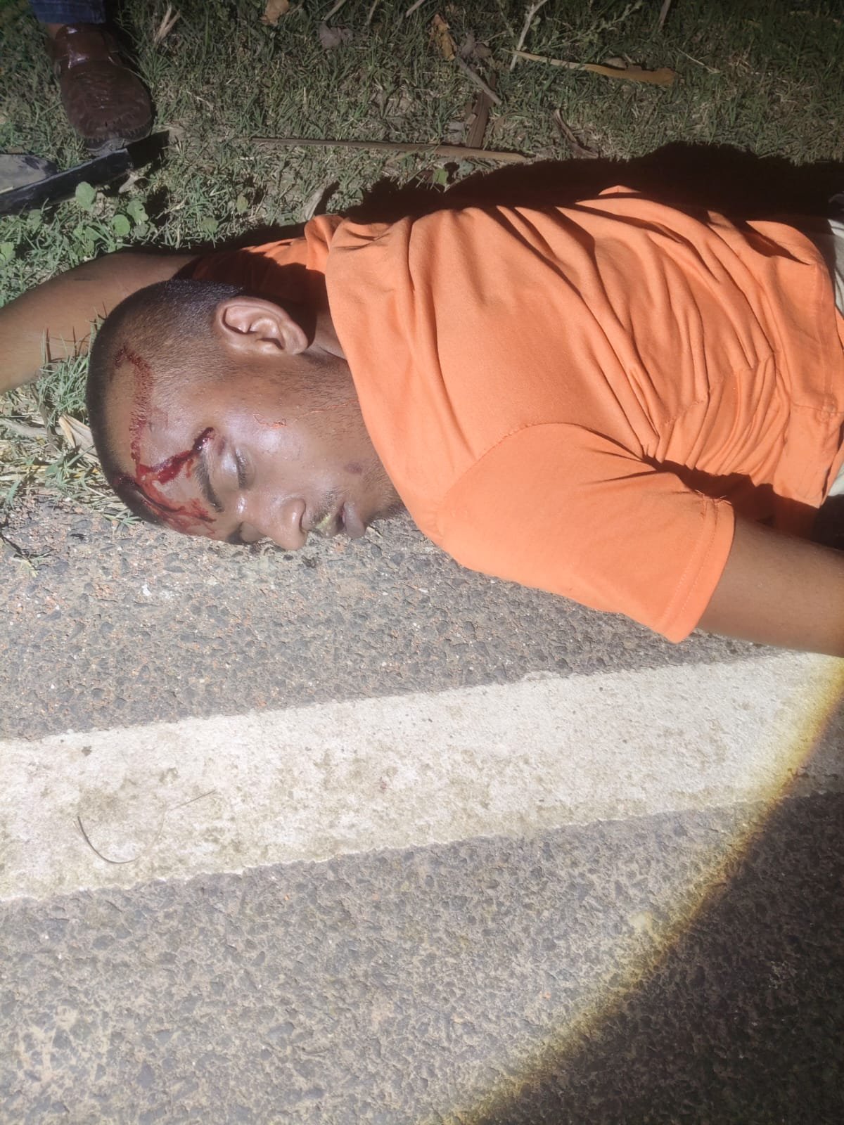 परबत्ता: ट्रैक्टर-ट्रॉली से टक्कर में युवक की मौत, दो घायल